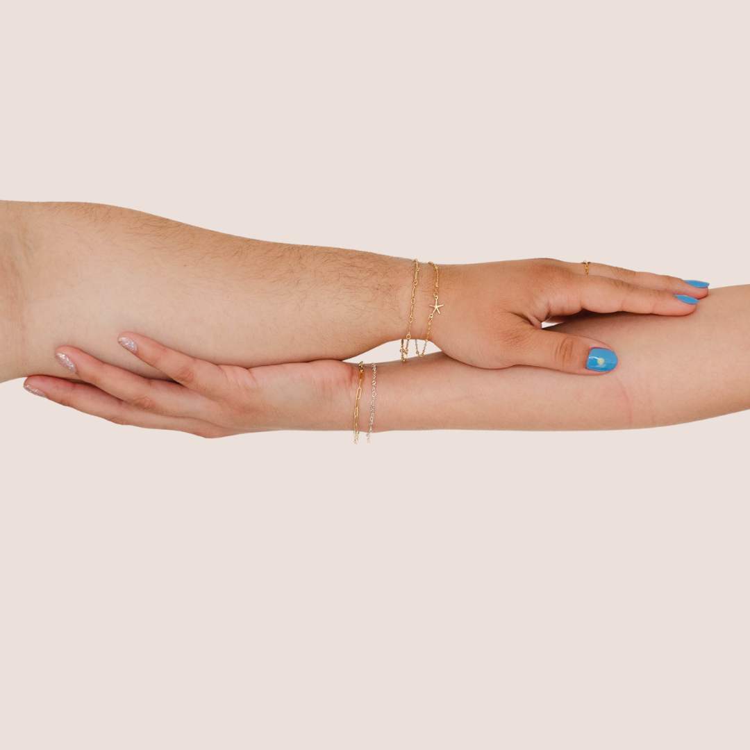 An image of two hands with permanent bracelets